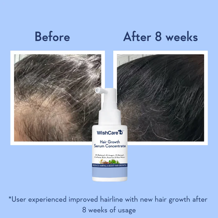 WishCare Hair Serum before after 8 weeks